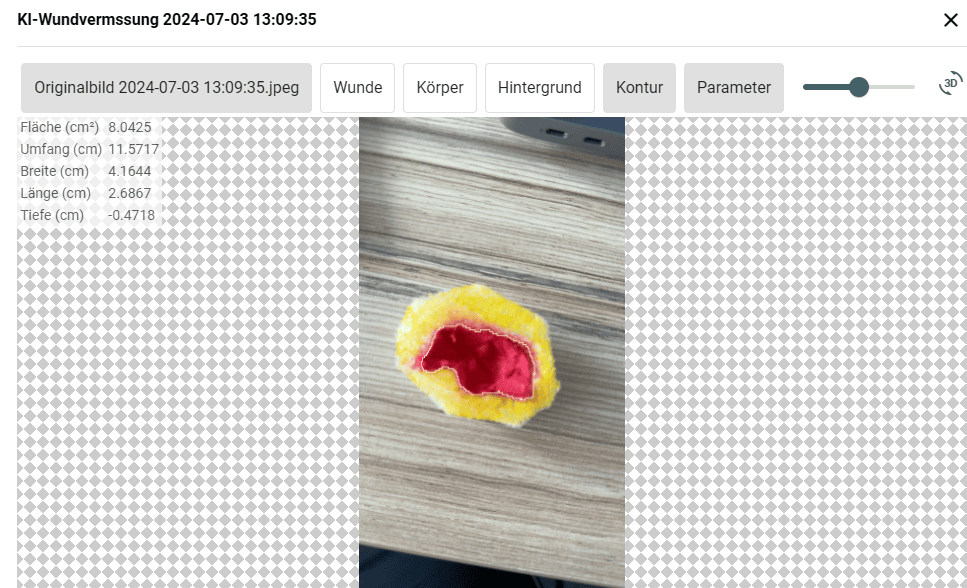 KI-Wundanalyse & KI-Kommunikationsmodul